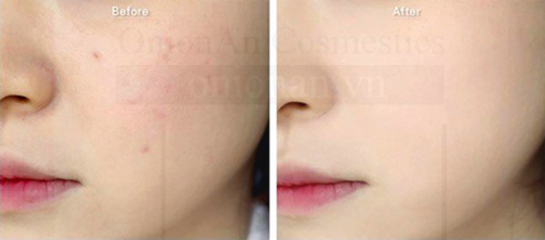  Phấn Phủ Cellio Ex Collagen Twoway Cake SPF30 PA+++